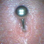 Lesao_piercing_de_lingua_1
