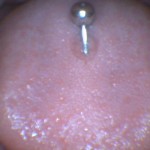 lesao_piercing_de_lingua_2