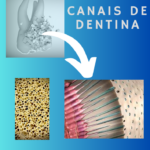 sensibilidade-dentaria